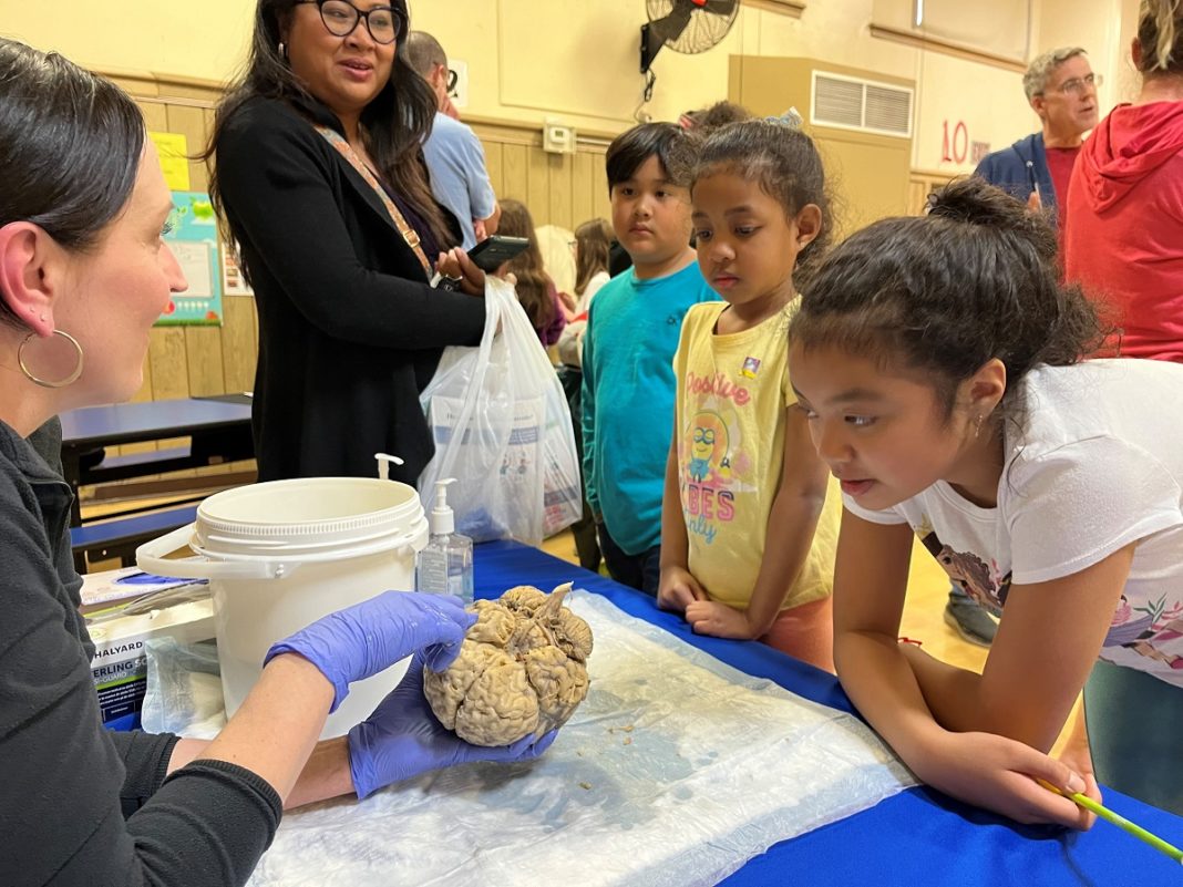 A group of children huddle around a woman pointing to a disembodied human brain.