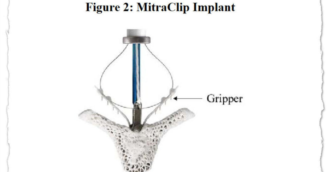 From Dr. Oz to heart valves: A tiny device charted a contentious path through the FDA