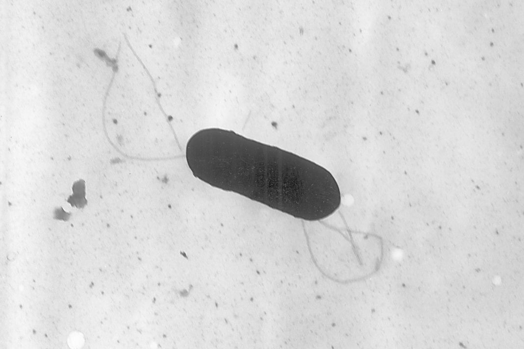 A 2002 electron microscope image made available by the Centers for Disease Control and Prevention shows a Listeria monocytogenes bacterium, responsible for the food borne illness listeriosis.